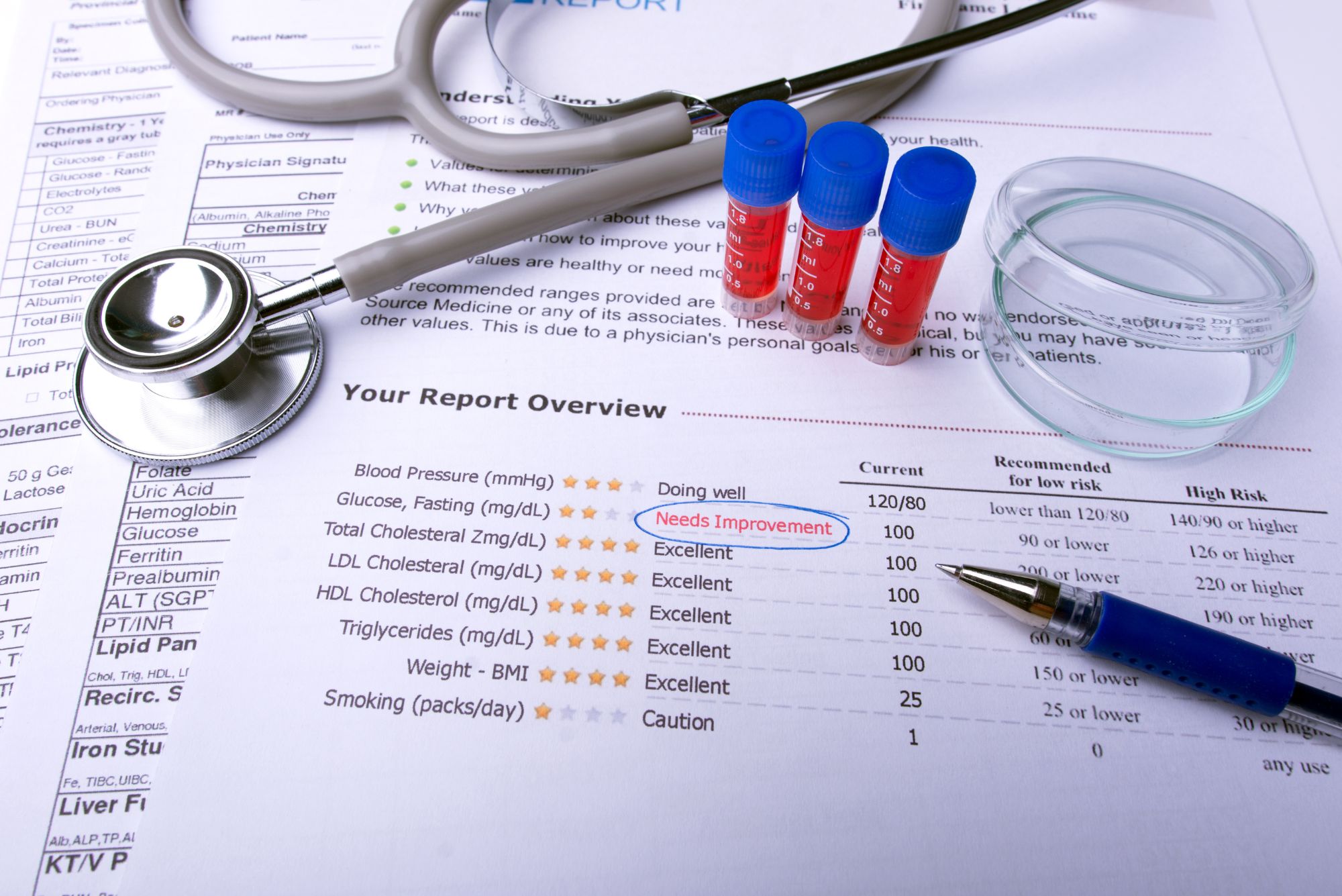 Lab test results sit on a desk with blood samples, a stethoscope, a pen, and a petri dish.