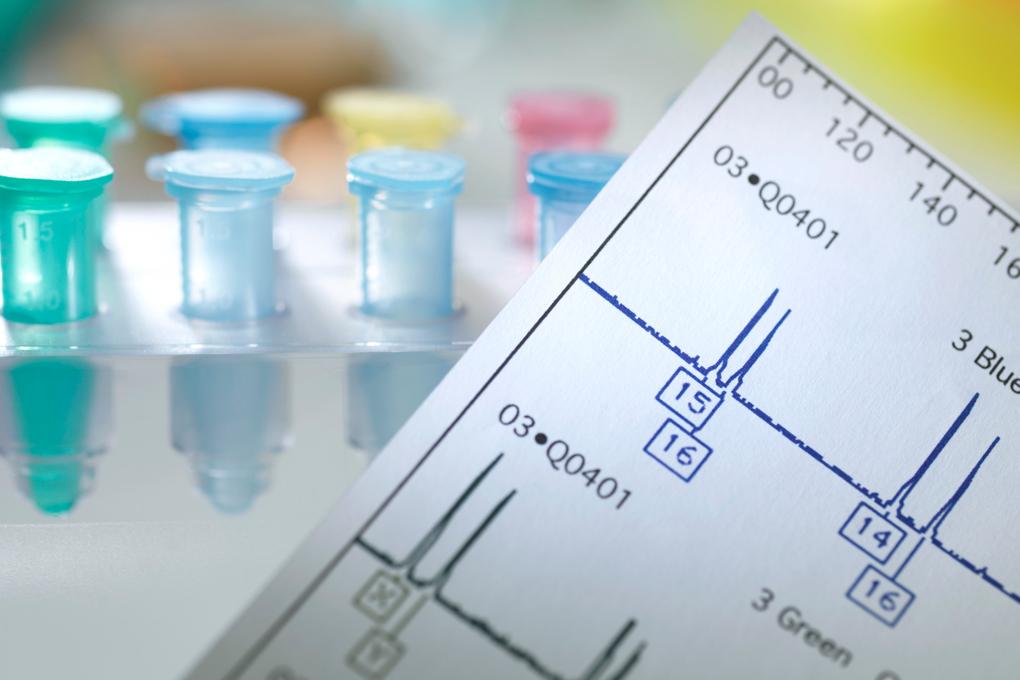 A piece of paper showing the test results of someone who wondered, 