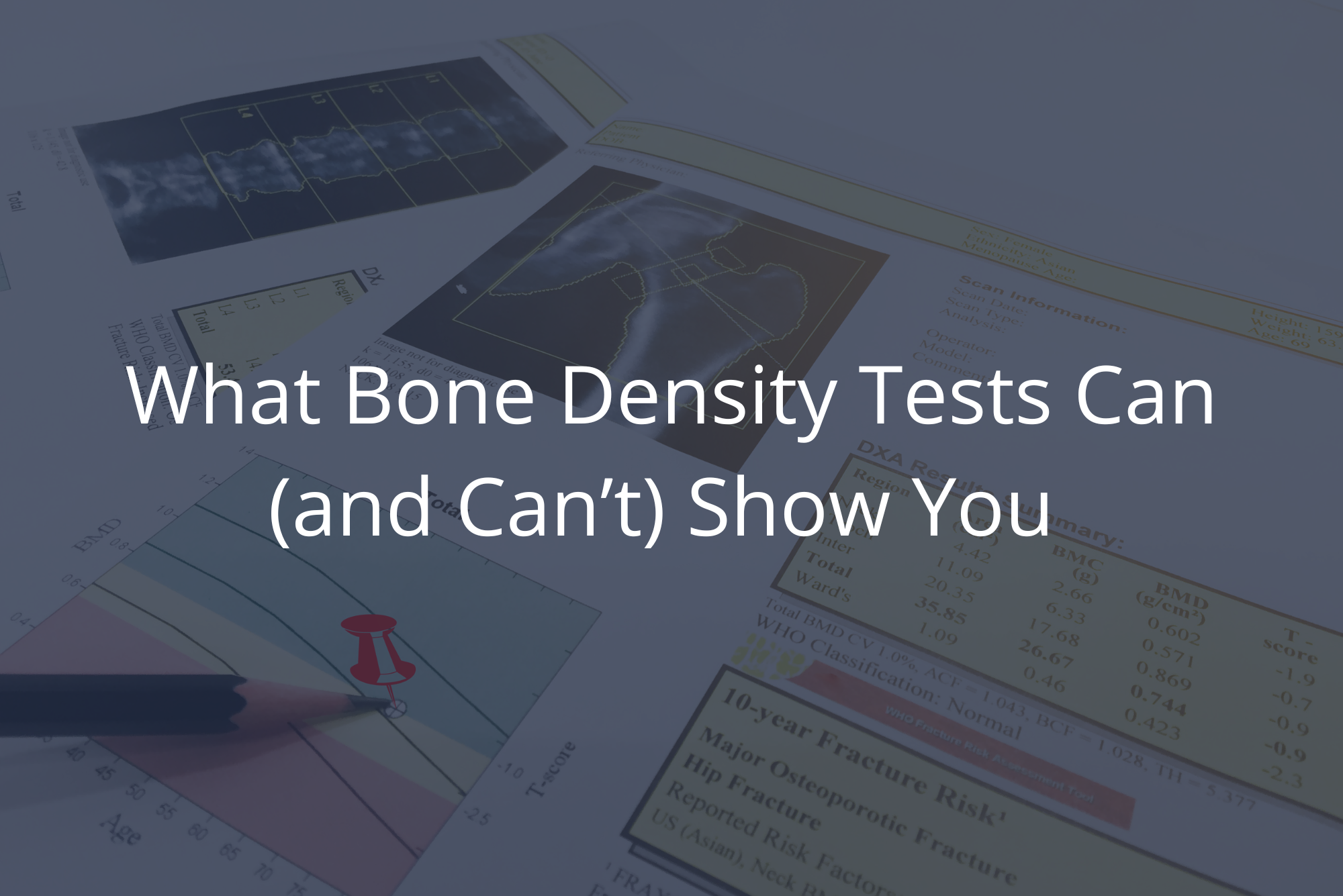 Results from a bone density test lay on a table, showing what they can detect, with a dark overlay.
