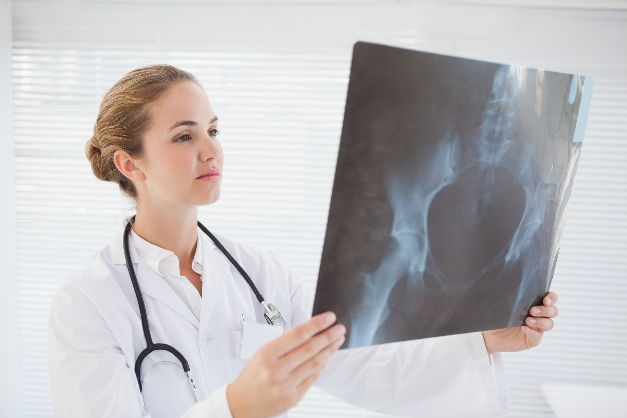 A female doctor looks at the pelvic X-ray of a patient who has been practicing tips or increasing bone density.